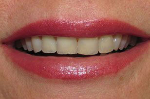 Dental Implants Dentist Oklahoma City