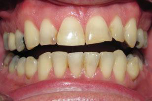 Dental Implants Dentist Oklahoma City