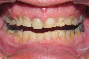 Oklahoma City Cosmetic Dentist