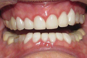 Emergency Dentist Oklahoma City