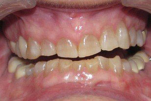 Oklahoma City Cosmetic Dentist