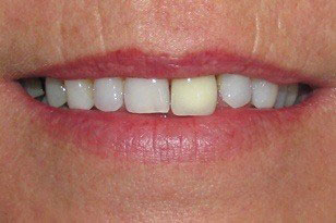 Family Dentist in Oklahoma City