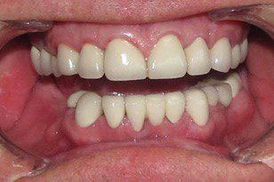 Dental Implants Dentist Oklahoma City