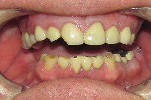 Emergency Dentist Oklahoma City