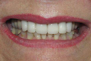 Oklahoma City Cosmetic Dentist