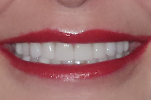 Iconic Dental Arts | Emergency Treatment, Oral Cancer Screening and Oral Exams