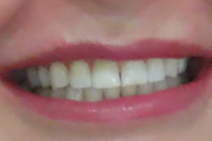 Iconic Dental Arts | Same-Day Crowns, Emergency Treatment and TMJ Disorders