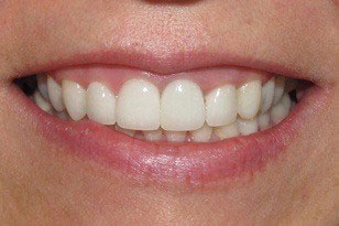 Emergency Dentist Oklahoma City