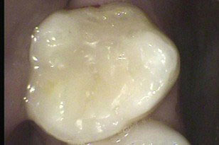 Family Dentist in Oklahoma City