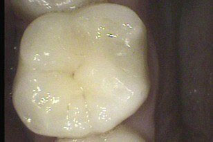 Family Dentist in Oklahoma City