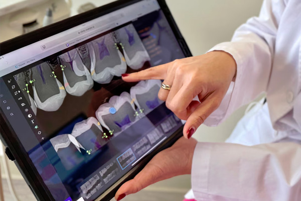 Iconic Dental Arts | Root Canals, Oral Cancer Screening and Night Guards