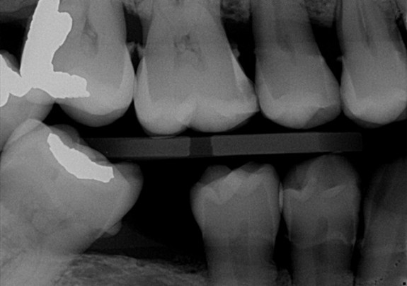 Iconic Dental Arts | Preventative Program, Night Guards and Dental Cleanings