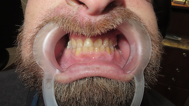 Iconic Dental Arts | Sedation Dentistry, Intraoral Camera and Oral Cancer Screening