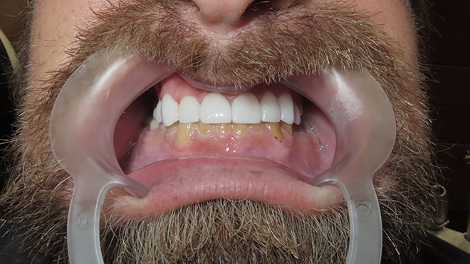 Iconic Dental Arts | Smile Gallery, Dentures and Oral Cancer Screening